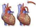 Blalock–Taussig Shunt – left subclavian artery to left pulmonary artery.