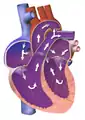 Blood flow in a neonate