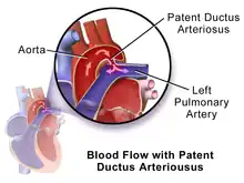 Illustration of PDA