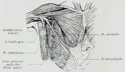 An individual with an abdominal portion of the pectoralis major, and an accessory sternalis muscle. Both these are anatomical variations.