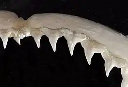 Upper teeth