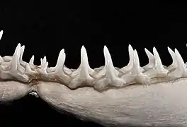 Lower teeth