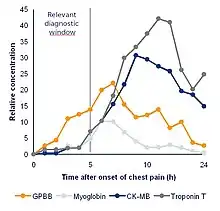 Comparison of cardiac marker in the first hours after chestpain onset and the relative concentration.