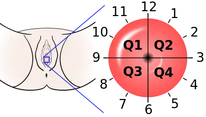 The location of cervical cancer can be described in terms of quadrants, or corresponding to a clock face when the subject is in supine position.