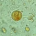 Immature E. histolytica cyst (mature cysts have 4 nuclei)