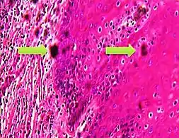 'Formalin pigment artifacts