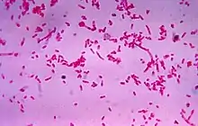 "Fusobacterium novum" in liquid culture