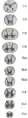 Cross-sections of the spinal cord at varying levels.