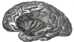 The insula of the left side, exposed by removing the opercula.