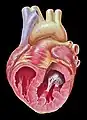 Opened chambers of the heart displaying papillary muscles and chordae tendineae