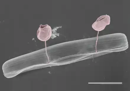 Pennate diatom from an Arctic meltpond, infected with two chytrid-like fungal pathogens. Scale bar = 10 µm.