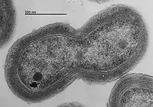 TEM of Prochlorococcus MED4 dividing