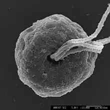 Flagellar pit of "Pyramimonas" sp. scale bar = 1.0μm