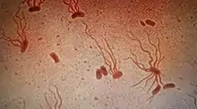 Causative agent: Salmonella enterica serological variant Typhi (shown under a microscope with flagellar stain)