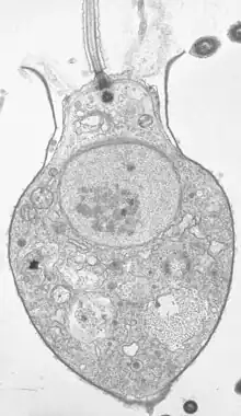 Salpingoeca sp. section under TEM