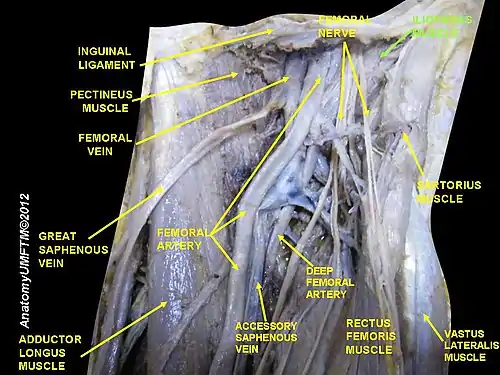 Iliopsoas muscle