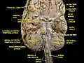 Cerebrum. Inferior view. Deep dissection.