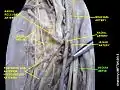 Median nerve