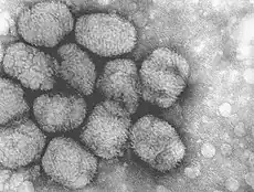 Electron micrograph of smallpox virus, similar to what Geddes would have seen in Parker's sample.