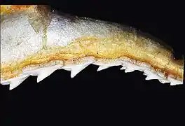 Upper teeth