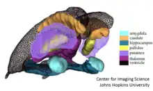 Figure showing triangualted meshes generated from populations of many segmented MRI brains. Each different surface represents a different shape in shape space.