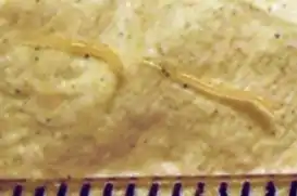 Pinworms ("Enterobius vermicularis")