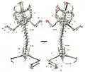 CT-scan