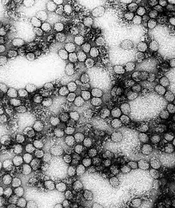 A TEM micrograph of the "Yellow fever virus"